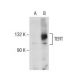 TERT (C-12): sc-377511. Western blot analysis of TERT expression in... 