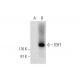 TERT (A-6): sc-393013. Western blot analysis of TERT expression in...