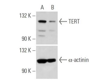 TERT siRNA (h): sc-36641. Western blot analysis of TERT expression in non-transfected control (A) and TERT (H-231) siRNA t 