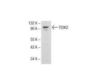 TESK2 Antibody (31-F) - Western Blotting - Image 72848 