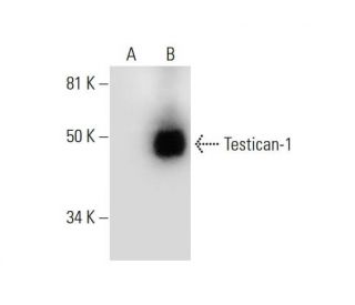 Testican-1 Antibody (C-3) - Western Blotting - Image 290010Each CRISPR/Cas9 Knockout (KO) Plasmid product consists of a pool of 3 plasmids designed to ensure identification and cleavage of a specific gene for maximum knockout efficiency. Each plasmid encodes a unique 20 nt sequence derived from the GeCKO (v2) library.