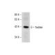 Testisin Antibody (A-11) - Western Blotting - Image 287755