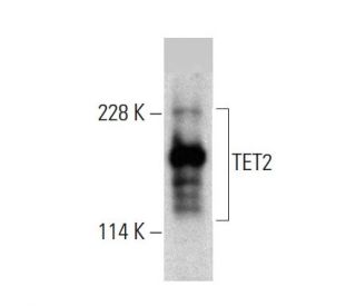 TET2 Antibody (C-7) - Western Blotting - Image 384019 