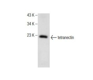 tetranectin Antibody (F-8) - Western Blotting - Image 160687Each CRISPR/Cas9 Knockout (KO) Plasmid product consists of a pool of 3 plasmids designed to ensure identification and cleavage of a specific gene for maximum knockout efficiency. Each plasmid encodes a unique 20 nt sequence derived from the GeCKO (v2) library.