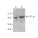 TEX10 Antibody (B-9) - Western Blotting - Image 371941