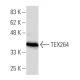 TEX264 Antibody (137.1) - Western Blotting - Image 34315