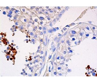 TEX44 Antibody (B-1) - Immunohistochemistry - Image 380070 