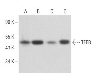 TFEB Antibody (17) - Western Blotting - Image 356666 