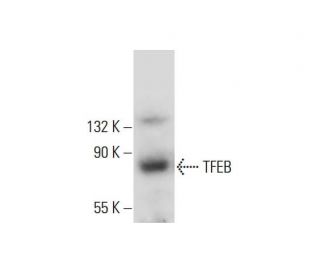 western blotting image from recommended TFEB (C-6) monoclonal antibody replacement. Image 317970