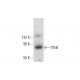 Cet anticorps polyclonal n'est plus commercialisé. Voir l'anticorps monoclonal <a href="tfeb-antibody-c-6">TFEB (C-6)</a> que nous recommandons (données d'échantillonnage indiquées). western blotting image from recommended TFEB (C-6) monoclonal antibody replacement. Image 317970