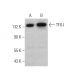 This polyclonal antibody has been discontinued. See our recommended <a href="tfii-i-antibody-b-7">TFII-I (B-7)</a> monoclonal antibody (sample data shown). western blotting image from recommended TFII-I (B-7) monoclonal antibody replacement. Image 372602