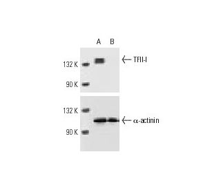 TFII-I siRNA (h): sc-36643. Western blot analysis of TFII-I expression in non-transfected control (A) and TFII-I siRNA tra 