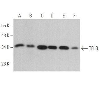 western blotting image from recommended TFIIB (D-3) monoclonal antibody replacement. Image 380757