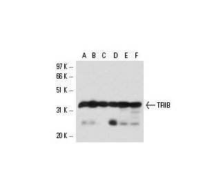 TFIIB Antibody (IIB1) - Western Blotting - Image 17179 