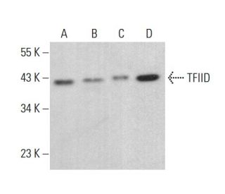 TFIID/TATA Binding Protein/TBP Antibody (1TBP22) - Western Blotting - Image 378515 