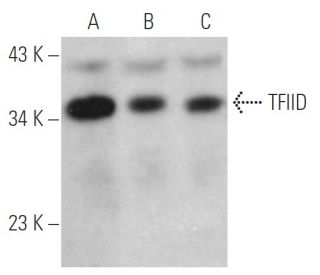 TFIID/TATA Binding Protein/TBP Antibody (58C9) - Western Blotting - Image 374816 