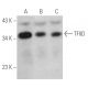 western blotting image from recommended TFIID/TATA Binding Protein/TBP (58C9) monoclonal antibody replacement. Image 374816