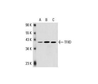 TFIID/TATA Binding Protein/TBP Antibody (1TB18) - Western Blotting - Image 17535 