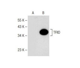 TFIID/TATA Binding Protein/TBP Antibody (C-8) - Western Blotting - Image 147833