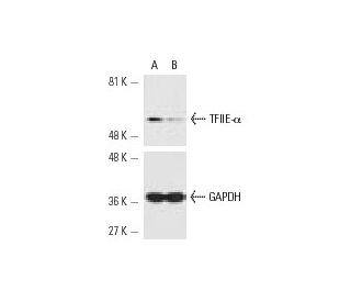 TFIIE-&alpha; siRNA (h): sc-36651. Western blot analysis of TFIIE-&alpha; expression in non-transfected control (A) and TF 