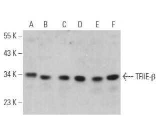 western blotting image from recommended TFIIE-&beta; (A-1) monoclonal antibody replacement. Image 374502