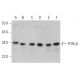 western blotting image from recommended TFIIE-β (A-1) monoclonal antibody replacement. Image 374502