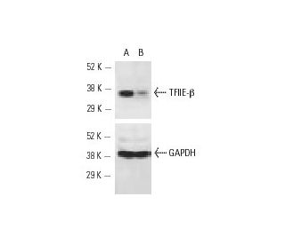 TFIIE-&beta; siRNA (h): sc-36650. Western blot analysis of TFIIE-&beta; expression in non-transfected control (A) and TFII 