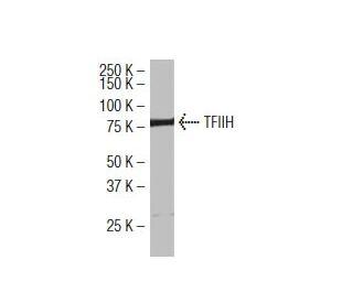 TFIIH p80 Antibody (184.7) - Western Blotting - Image 34536 