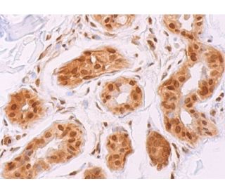 immunohistochemistry image from recommended TFIIH p80 (G-2) monoclonal antibody replacement. Image 378078