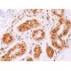 This polyclonal antibody has been discontinued. See our recommended <a href="tfiih-p80-antibody-g-2">TFIIH p80 (G-2)</a> monoclonal antibody (sample data shown). immunohistochemistry image from recommended TFIIH p80 (G-2) monoclonal antibody replacement. Image 378078