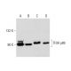 This polyclonal antibody has been discontinued. See our recommended <a href="tfiih-p89-antibody-g-10">TFIIH p89 (G-10)</a> monoclonal antibody (sample data shown). western blotting image from recommended TFIIH p89 (G-10) monoclonal antibody replacement. Image 144792