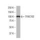 TFIIIC102 Antibody (X-421) - Western Blotting - Image 34538