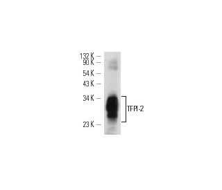 TFPI-2 Antibody (B-7) - Western Blotting - Image 12711 