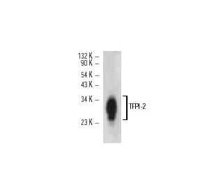 TFPI-2 Antibody (C-3) - Western Blotting - Image 12468