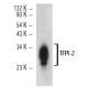TFPI-2 Antibody (C-3) - Western Blotting - Image 12468