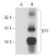 TFPI Antibody (G-1) - Western Blotting - Image 58205