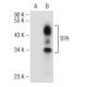 TFPI Antibody (G-5) - Western Blotting - Image 146369