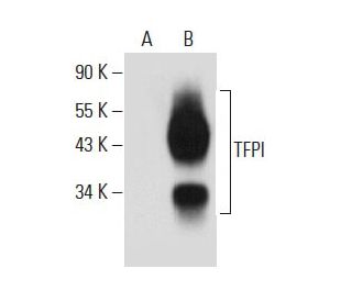 TFPI Antibody (G-6) | SCBT - Santa Cruz Biotechnology