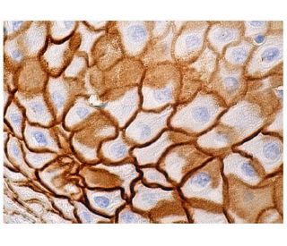 immunohistochemistry image from recommended TGase1 (A-5) monoclonal antibody replacement. Image 281087