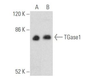 TGase1 Antibody (B-3) - Western Blotting - Image 355492