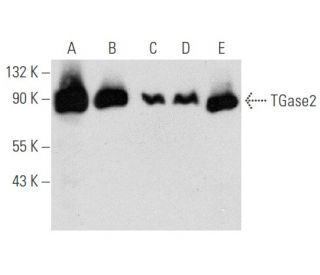 TGase2 Antibody (4G3) - Western Blotting - Image 354823 