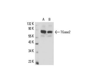 western blotting image from recommended TGase2 (E-3) monoclonal antibody replacement. Image 16305