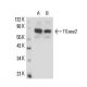 western blotting image from recommended TGase2 (E-3) monoclonal antibody replacement. Image 16305