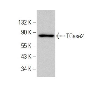 TGase2 Antibody (4G3) - Western Blotting - Image 384689The Double Nickase Plasmid features a U6 promoter for sgRNA expression, a 20 nt targeting sequence, and a gRNA scaffold to guide Cas9n. It includes a CBh promoter for Cas9n (D10A) and puromycin resistance, GFP for transfection verification, and nuclear localization signals (NLS). The 2A peptide allows co-expression of Cas9n and Puro from a single promoter, enabling precise genome editing with reduced off-target effects.