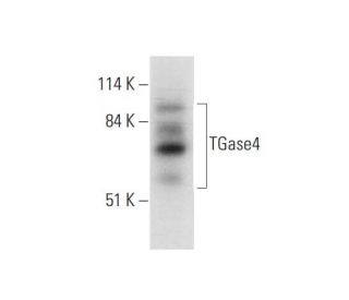 TGase4 Antibody (C-11) - Western Blotting - Image 333354 