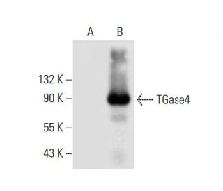 TGase4 Antibody (C-12) - Western Blotting - Image 306628