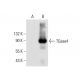 TGase4 Antibody (C-12) - Western Blotting - Image 306628