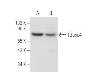 TGase4 Antibody (E-10) - Western Blotting - Image 306614 