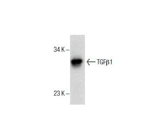 TGF beta 1 Antibody (2E6) - Western Blotting - Image 285912