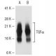 TGFα Antibody (134 A) - Western Blotting - Image 43723 